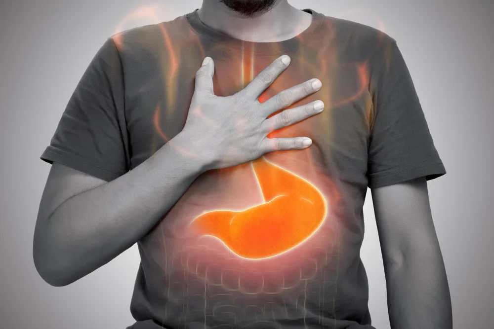 Tratamiento para enfermedad por reflujo gastroesofágico / gastritis en CDMX
